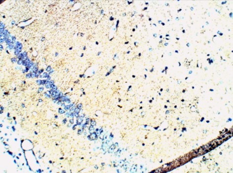 Immunohistochemistry (Formalin/PFA-fixed paraffin-embedded sections) - Anti-Synaptophysin antibody (AB14692), expandable thumbnail