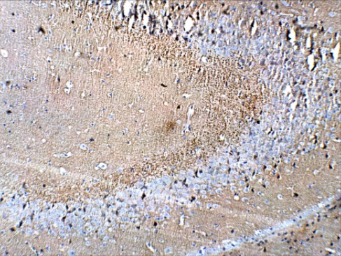 Immunohistochemistry (Formalin/PFA-fixed paraffin-embedded sections) - Anti-Synaptophysin antibody (AB14692), expandable thumbnail