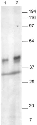 Western blot - Anti-Synaptophysin antibody - Synaptic Marker (AB14692)