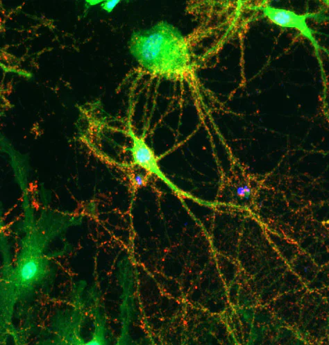 Immunocytochemistry/ Immunofluorescence - Anti-Synaptophysin antibody - Synaptic Marker (AB32594)
