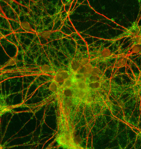 Immunocytochemistry/ Immunofluorescence - Anti-Synaptophysin antibody - Synaptic Marker (AB32594)
