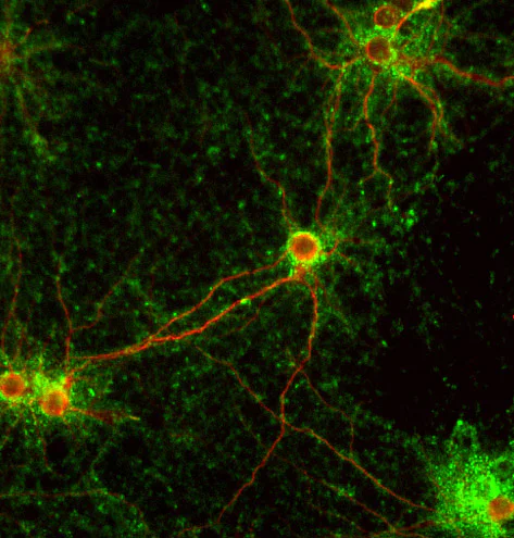 Immunocytochemistry/ Immunofluorescence - Anti-Synaptophysin antibody - Synaptic Marker (AB32594)