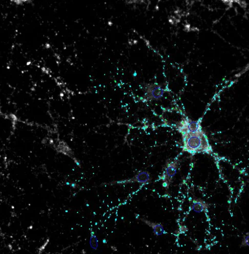 Immunocytochemistry/ Immunofluorescence - Anti-Synaptophysin antibody - Synaptic Marker (AB32594)