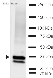Western blot - Anti-Synaptophysin antibody - Synaptic Marker (AB32594)