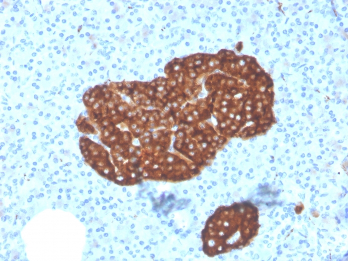 Immunohistochemistry (Formalin/PFA-fixed paraffin-embedded sections) - Anti-Synaptophysin antibody [SYP/3551] (AB260417), expandable thumbnail