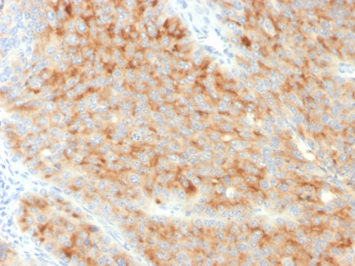 Immunohistochemistry (Formalin/PFA-fixed paraffin-embedded sections) - Anti-Synaptophysin antibody [SYP/3551] (AB260417), expandable thumbnail
