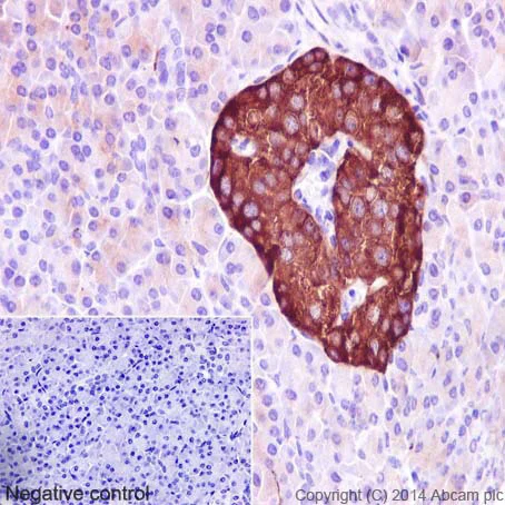 Immunohistochemistry (Formalin/PFA-fixed paraffin-embedded sections) - Anti-Synaptophysin antibody [YE269] - BSA and Azide free (AB187259)