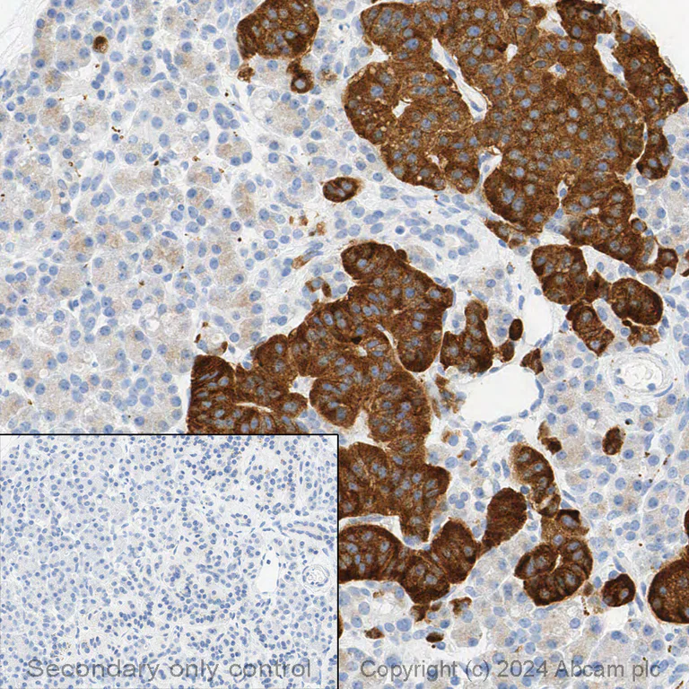 Immunohistochemistry (Formalin/PFA-fixed paraffin-embedded sections) - Anti-Synaptophysin antibody [YE269] - BSA and Azide free (AB187259)