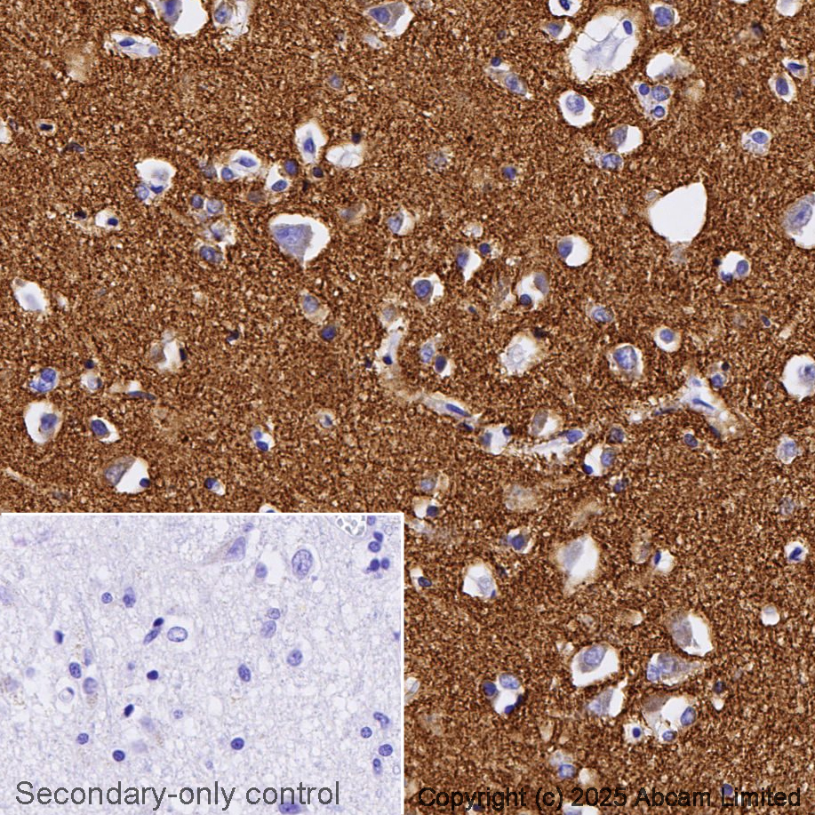 Immunohistochemistry (Formalin/PFA-fixed paraffin-embedded sections) - Anti-Synaptophysin antibody [YE269] - BSA and Azide free (ab187259), expandable thumbnail