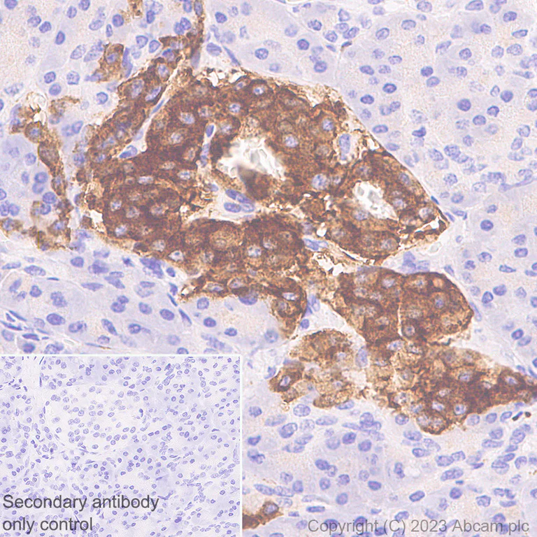 Immunohistochemistry (Formalin/PFA-fixed paraffin-embedded sections) - Anti-Synaptophysin antibody [YE269] - Mouse IgG1 (Chimeric) - BSA and Azide free (AB309494)