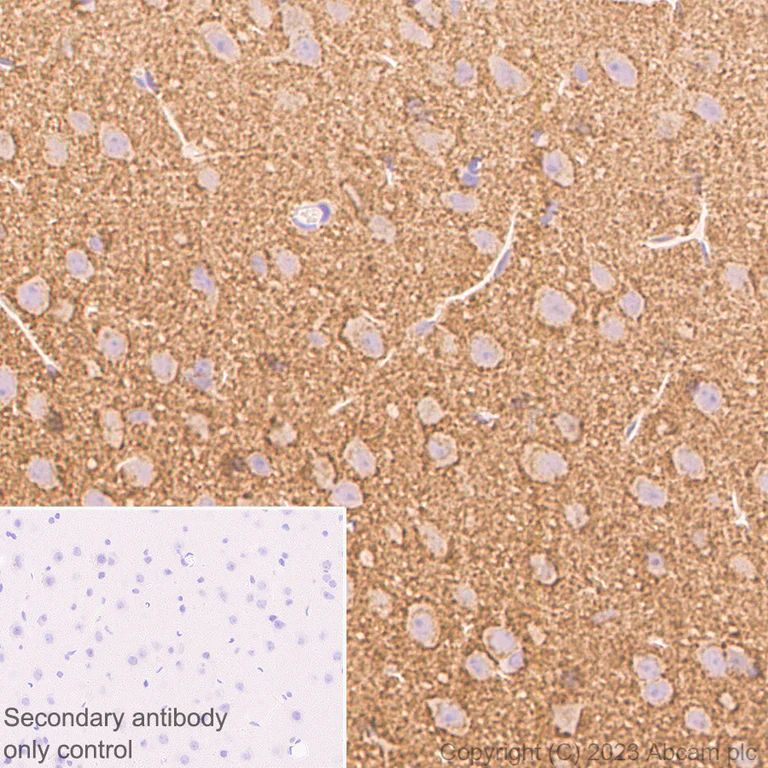 Immunohistochemistry (Formalin/PFA-fixed paraffin-embedded sections) - Anti-Synaptophysin antibody [YE269] - Mouse IgG1 (Chimeric) - BSA and Azide free (AB309494)