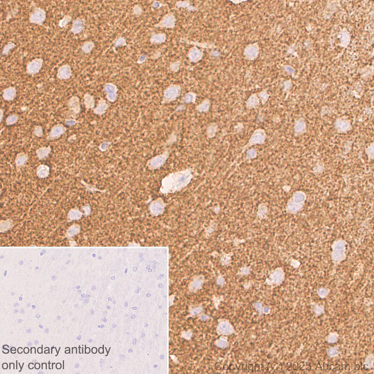 Immunohistochemistry (Formalin/PFA-fixed paraffin-embedded sections) - Anti-Synaptophysin antibody [YE269] - Mouse IgG1 (Chimeric) - BSA and Azide free (AB309494)