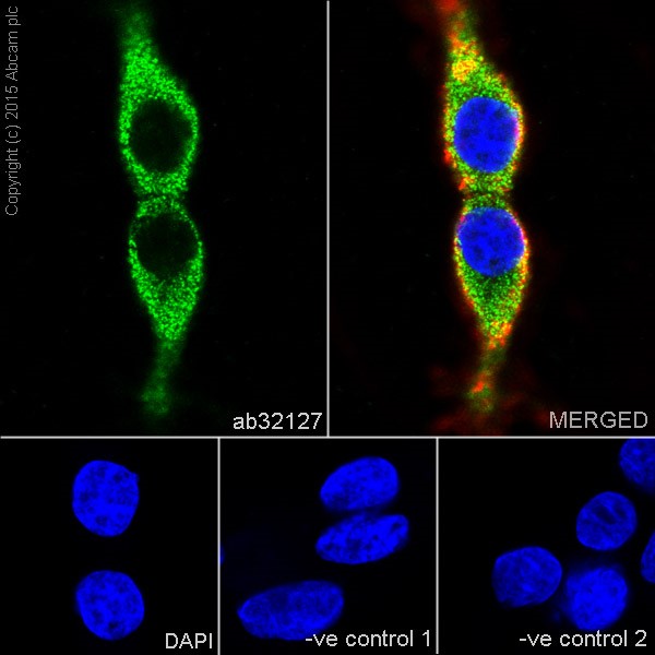 Immunocytochemistry/ Immunofluorescence - Anti-Synaptophysin antibody [YE269] (ab32127), expandable thumbnail