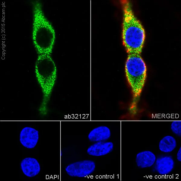 Immunocytochemistry/ Immunofluorescence - Anti-Synaptophysin antibody [YE269] - Synaptic Marker (AB32127)