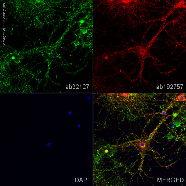 Immunocytochemistry/ Immunofluorescence - Anti-Synaptophysin antibody [YE269] (AB32127), expandable thumbnail