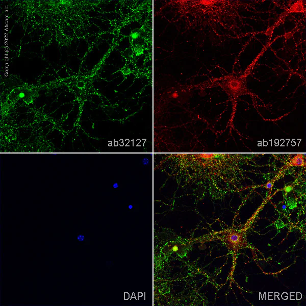 Immunocytochemistry/ Immunofluorescence - Anti-Synaptophysin antibody [YE269] - Synaptic Marker (AB32127)