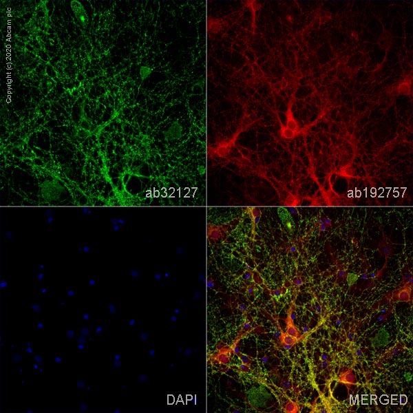 Immunocytochemistry/ Immunofluorescence - Anti-Synaptophysin antibody [YE269] (AB32127), expandable thumbnail