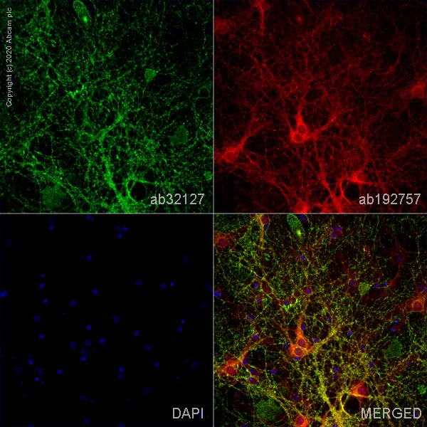 Immunocytochemistry/ Immunofluorescence - Anti-Synaptophysin antibody [YE269] - Synaptic Marker (AB32127)