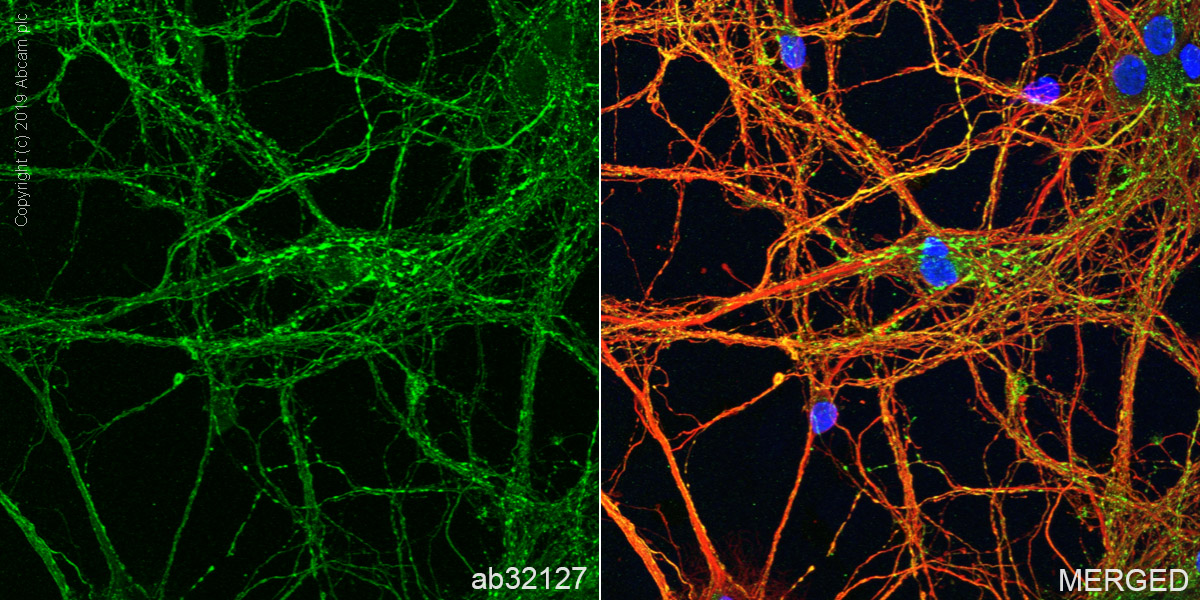 Immunocytochemistry/ Immunofluorescence - Anti-Synaptophysin antibody [YE269] (ab32127), expandable thumbnail