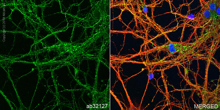 Immunocytochemistry/ Immunofluorescence - Anti-Synaptophysin antibody [YE269] - Synaptic Marker (AB32127)