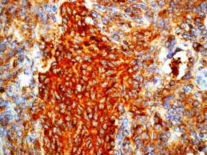 Immunohistochemistry (Formalin/PFA-fixed paraffin-embedded sections) - Anti-Synaptophysin antibody [YE269] (ab32127), expandable thumbnail