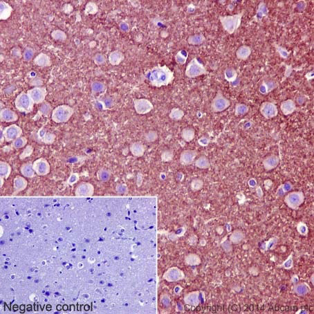 Immunohistochemistry (Formalin/PFA-fixed paraffin-embedded sections) - Anti-Synaptophysin antibody [YE269] (AB32127), expandable thumbnail