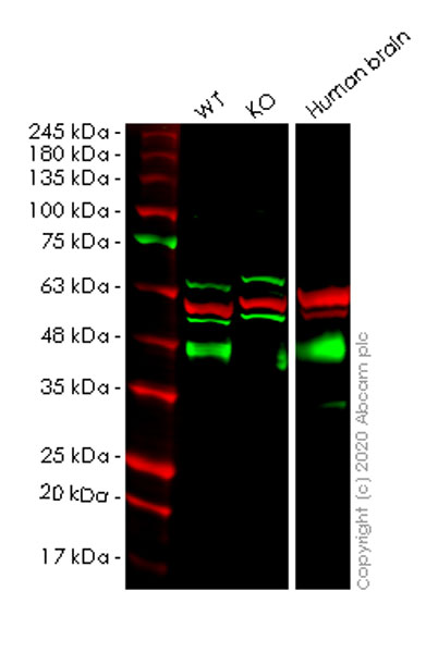 Western blot - Anti-Synaptophysin antibody [YE269] - Synaptic Marker (ab32127), expandable thumbnail