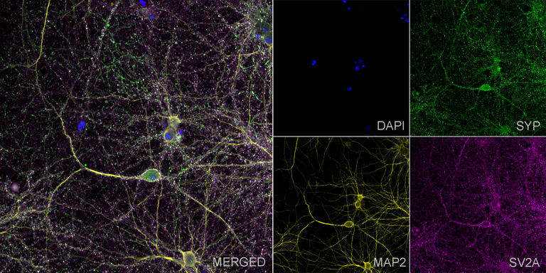 Immunocytochemistry/ Immunofluorescence - Anti-Synaptophysin antibody [YE269] - Synaptic marker - Mouse IgG1 (Chimeric) (AB309493)