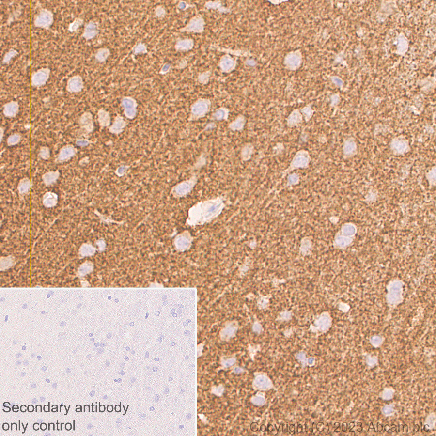 Anti-Synaptophysin 抗体 [YE269] - Mouse IgG1 (Chimeric) (ab309493