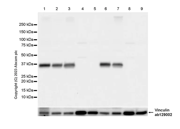 Western blot - Anti-Synaptophysin antibody [YE269] - Synaptic marker - Mouse IgG1 (Chimeric) (AB309493)