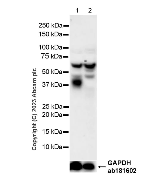 Western blot - Anti-Synaptophysin antibody [YE269] - Synaptic marker - Mouse IgG1 (Chimeric) (AB309493)