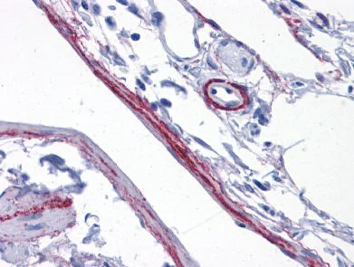 Immunohistochemistry (Formalin/PFA-fixed paraffin-embedded sections) - Anti-Synaptopodin antibody (AB117702)