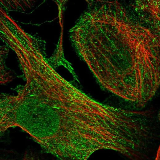 Immunocytochemistry/ Immunofluorescence - Anti-Synaptopodin antibody (AB224491)