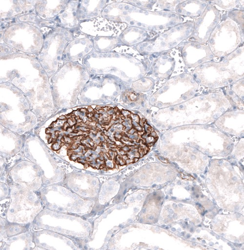 Anti-Synaptopodin antibody. Rabbit polyclonal (ab224491) | Abcam