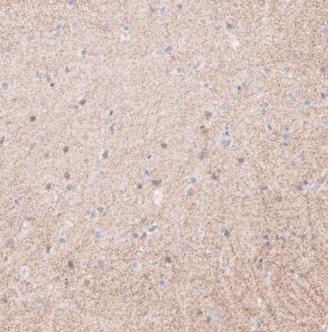 Immunohistochemistry (Formalin/PFA-fixed paraffin-embedded sections) - Anti-Synaptopodin antibody (AB224491)
