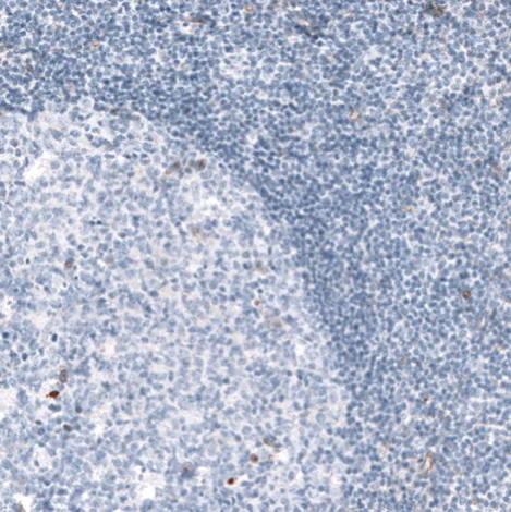 Immunohistochemistry (Formalin/PFA-fixed paraffin-embedded sections) - Anti-Synaptopodin antibody (AB224491)
