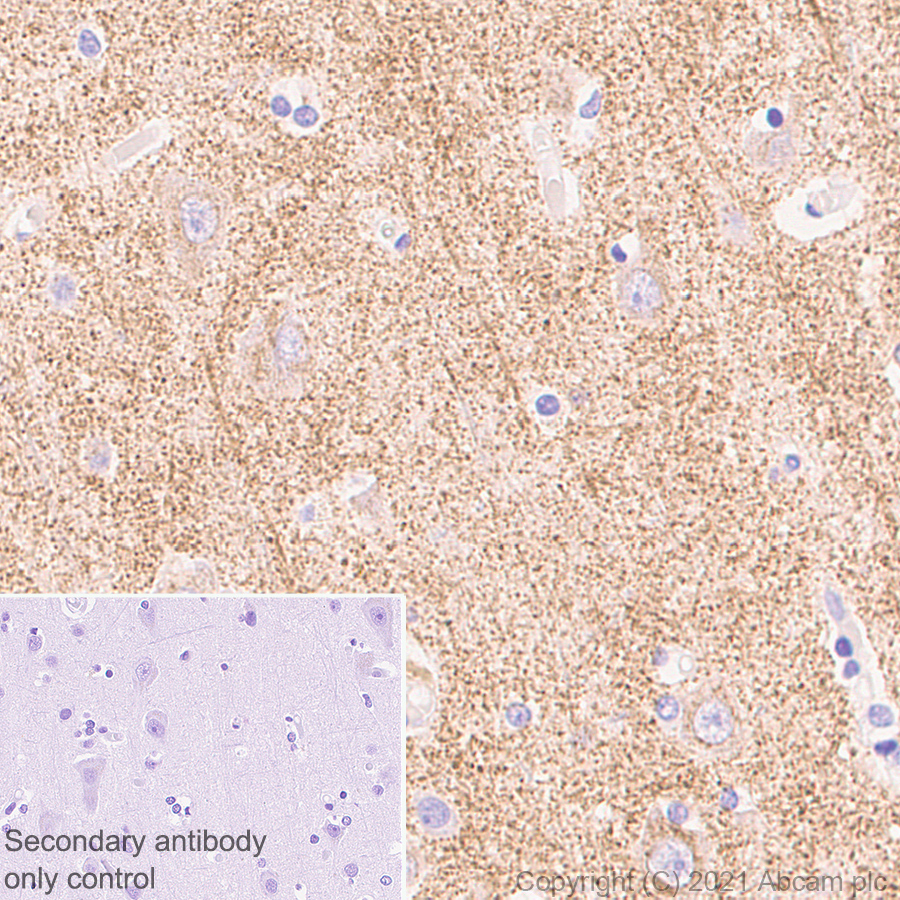 Immunohistochemistry (Formalin/PFA-fixed paraffin-embedded sections) - Anti-Synaptopodin antibody [EPR23922-79] (ab259976), expandable thumbnail