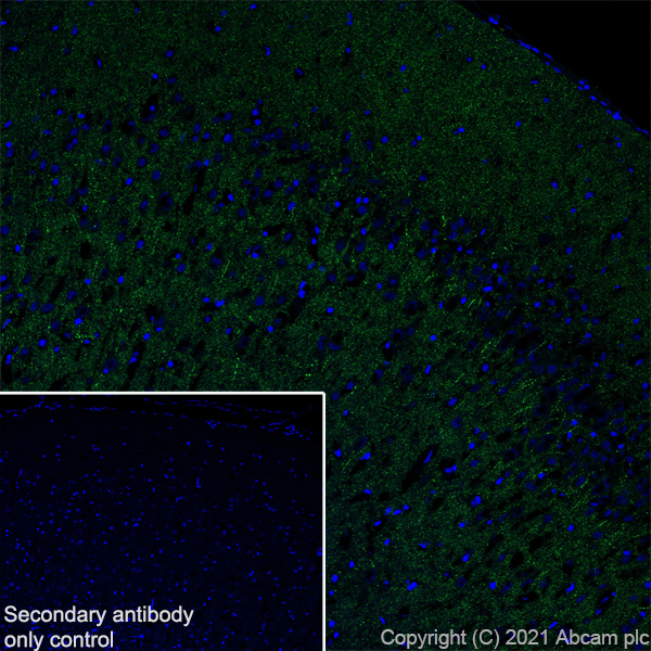 Immunohistochemistry (Frozen sections) - Anti-Synaptopodin antibody [EPR23922-79] (ab259976), expandable thumbnail