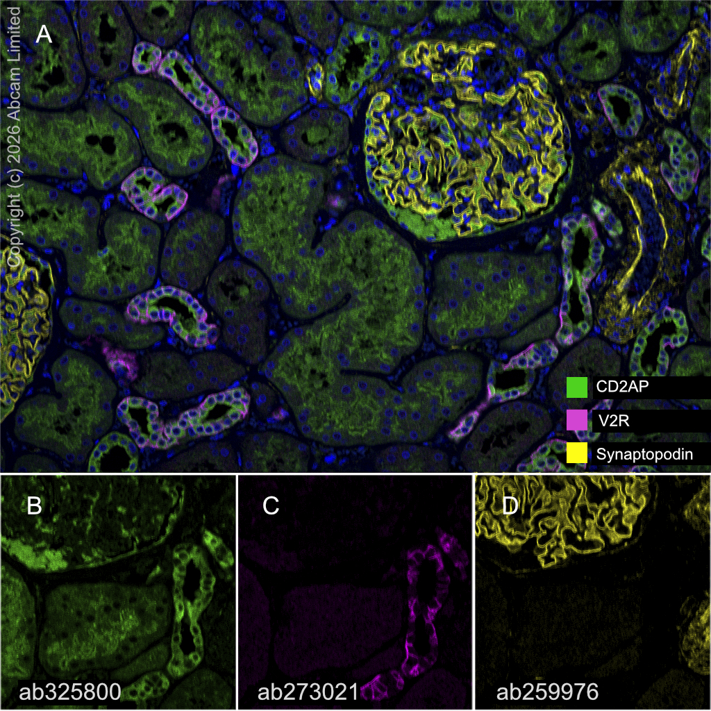 Multiplex immunohistochemistry - Anti-Synaptopodin antibody [EPR23922-79] (AB259976)