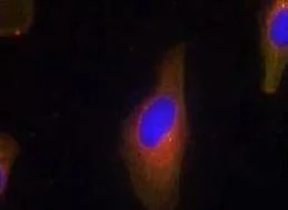 Immunocytochemistry/ Immunofluorescence - Anti-Synaptotagmin 1 + 2 antibody (AB131548)