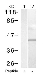 Western blot - Anti-Synaptotagmin 1 + 2 antibody (AB131548)