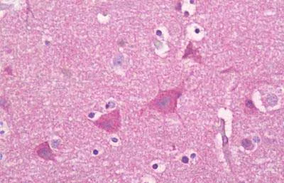 Immunohistochemistry (Formalin/PFA-fixed paraffin-embedded sections) - Anti-Synaptotagmin antibody (AB133694)