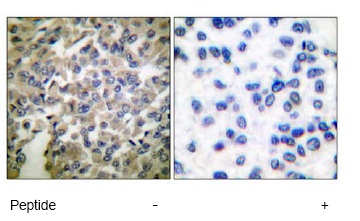 Immunohistochemistry (Formalin/PFA-fixed paraffin-embedded sections) - Anti-Synaptotagmin antibody (AB51164)