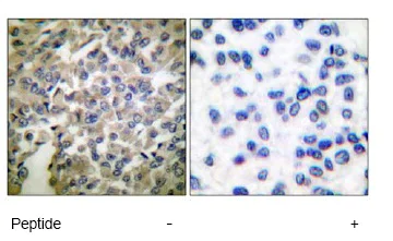 Immunohistochemistry (Formalin/PFA-fixed paraffin-embedded sections) - Anti-Synaptotagmin antibody (AB51164)