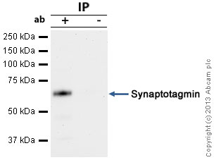 Immunoprecipitation - Anti-Synaptotagmin antibody [ASV30] (AB13259), expandable thumbnail