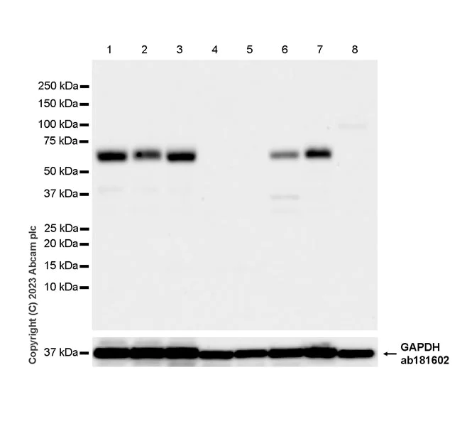 Western blot - Anti-Synaptotagmin VII antibody [EPR27957-6] (AB311843)