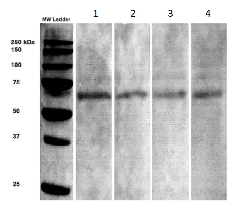 Western blot - Anti-Synaptotagmin VII antibody [N275/14] (AB174633)