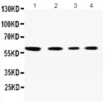 Western blot - Anti-SynCAM/CADM1 antibody - N-terminal (AB191046)