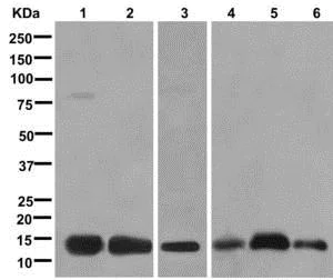 Western blot - Anti-Syncollin antibody [EPR13149] (AB178413)
