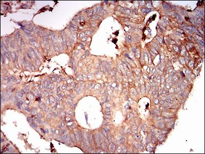 Immunohistochemistry (Formalin/PFA-fixed paraffin-embedded sections) - Anti-Syndecan-1 antibody [1A3H4] (ab181789), expandable thumbnail
